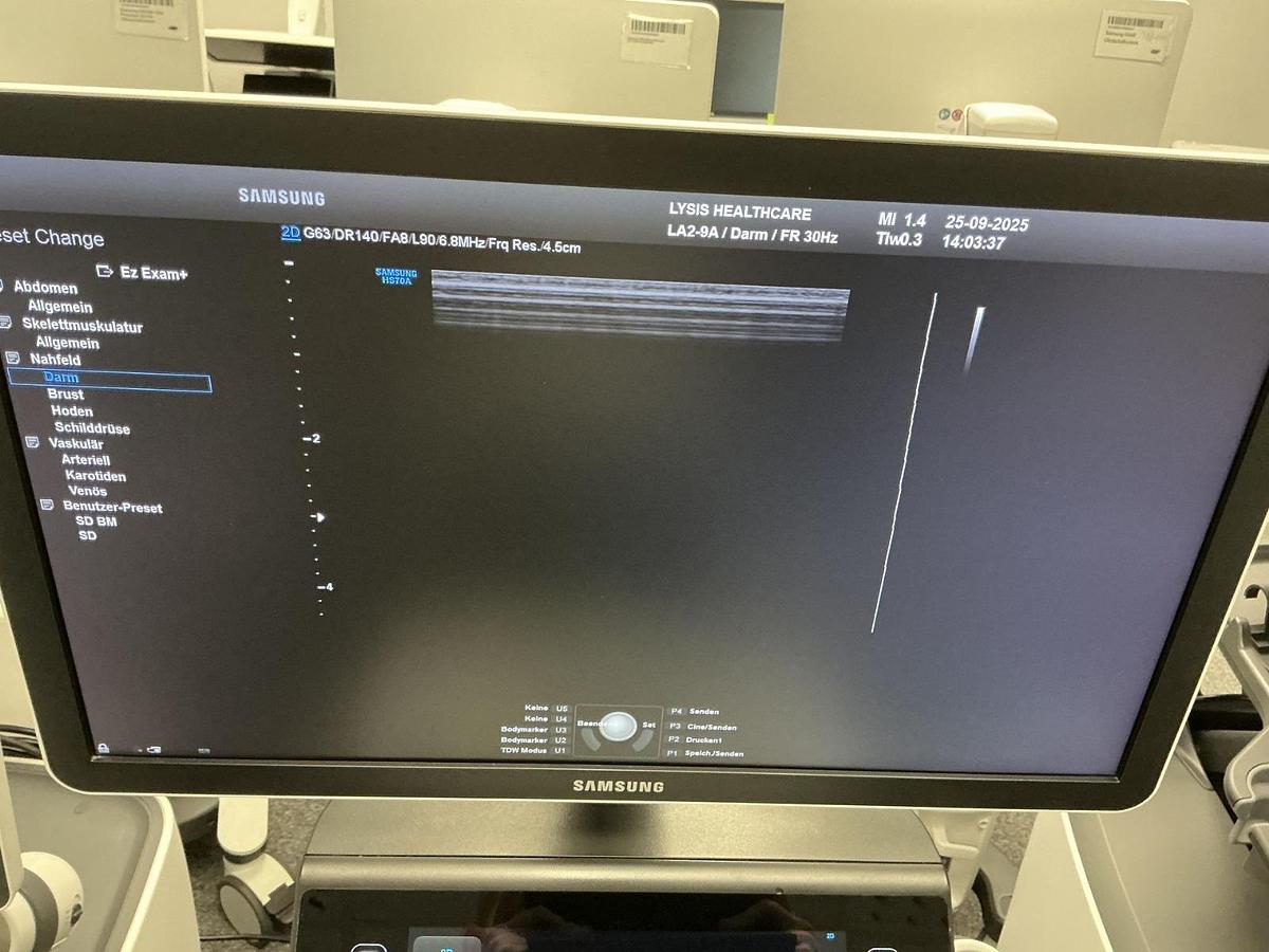 D'occasion ECHOGRAPHE SAMSUNG HS60 (2019)