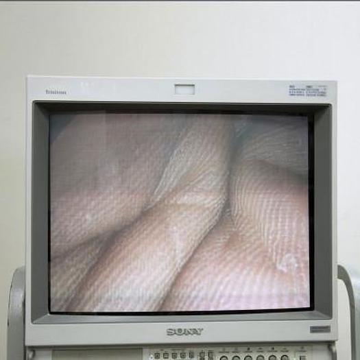 Used LEMKE LAPAROSCOPY COLUMN WITH LARGE SCREEN
