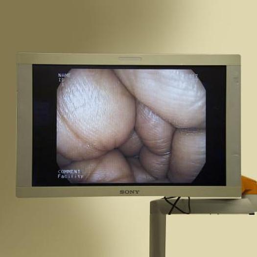Used PENTAX GASTROENTEROLOGY COLUMN WITH 28" FLAT SCREEN