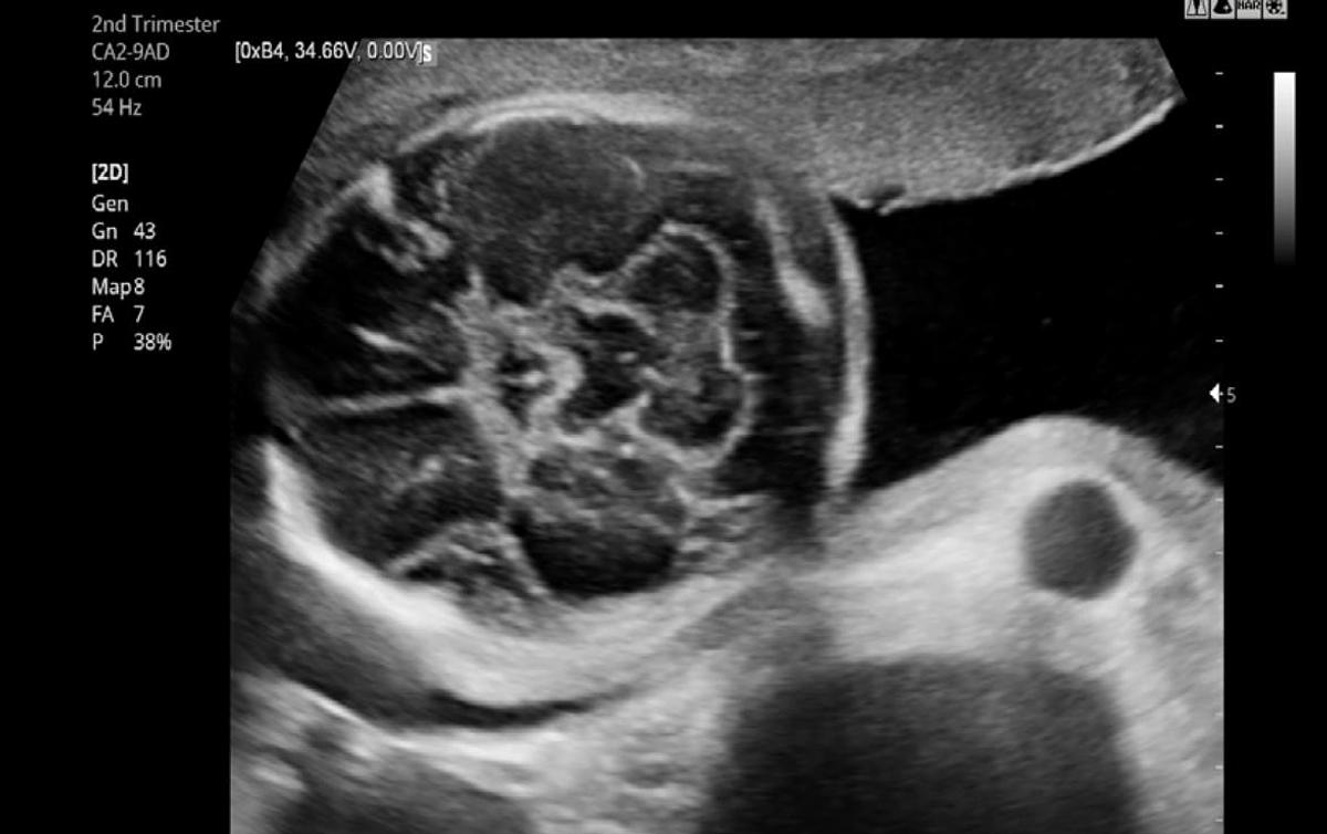 D'occasion SAMSUNG HS50 ULTRASOUND MACHINE