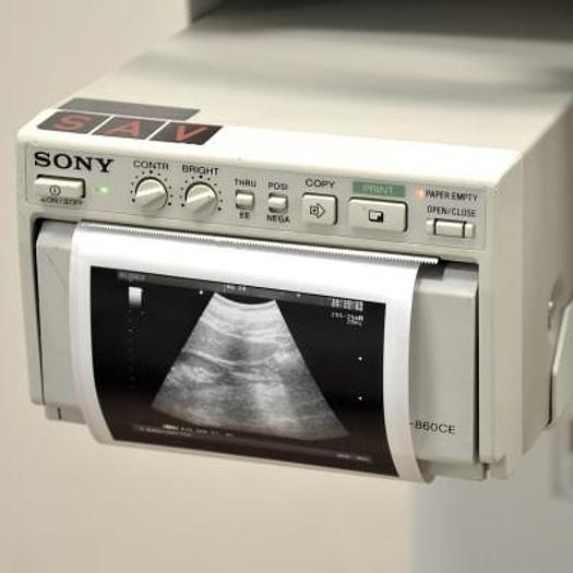 Used ALOKA/HITACHI PROSOUND 3500SX COLOR ULTRASOUND SCANNER