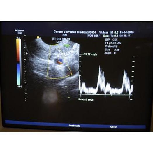 Used ACCUVIX XQ 3D/4D ULTRASOUND SCANNER WITH 4 PROBES
