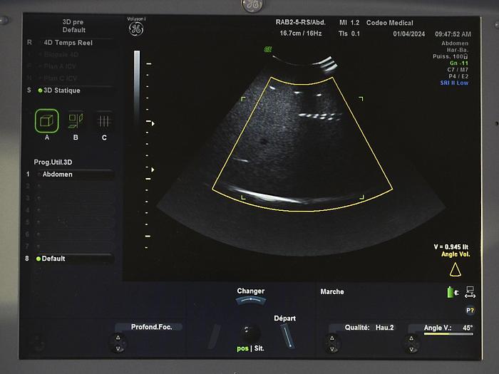 Used GENERAL ELECTRIC VOLUSON-I PORTABLE ULTRASOUND SCANNER ON CART