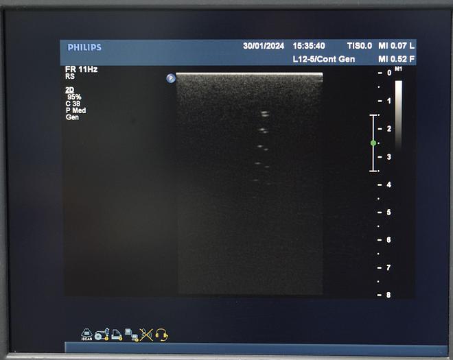 D'occasion ECHOGRAPHE PHILIPS IU22