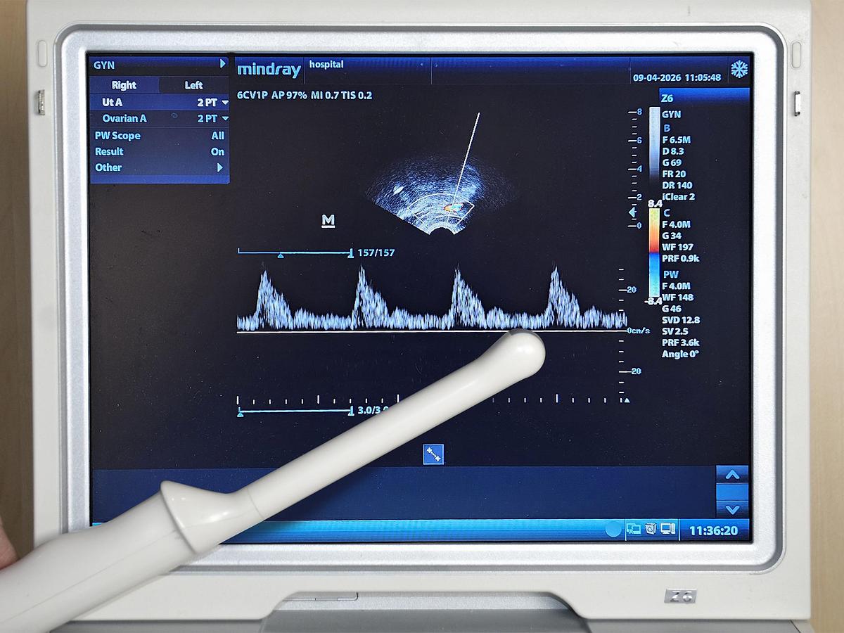 D'occasion MINDRAY Z6 PORTABLE ULTRASOUND SCREEN WITH TWO PROBES