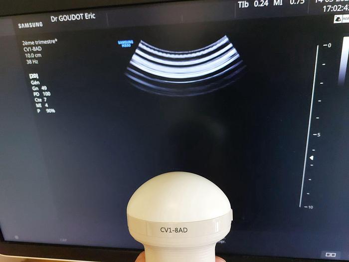 D'occasion SAMSUNG HS50 ULTRASOUND