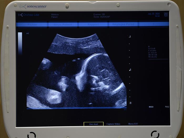 original-d-occasion-echographe-sonoscanner-orcheo-lite.jpg