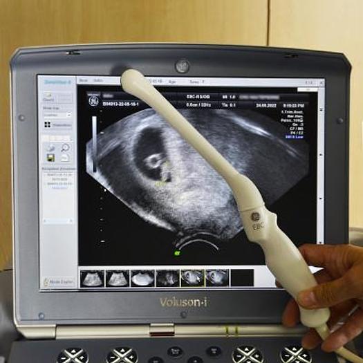 Used GENERAL ELECTRIC VOLUSON-i PORTABLE ECHOGRAPHY ON TROLLEY WITH 2 CONVEXAL AND ENDOVAGINAL PROBES
