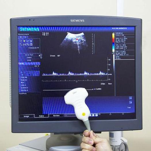 Used SIEMENS ACUSON ANTARES 5 FLAT SCREEN ULTRASOUND SCANNER WITH 3 PROBES