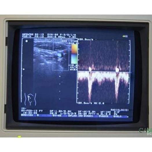 Used HITACHI EUB 525 COLOR DOPPLER ULTRASOUND WITH 2 PROBES