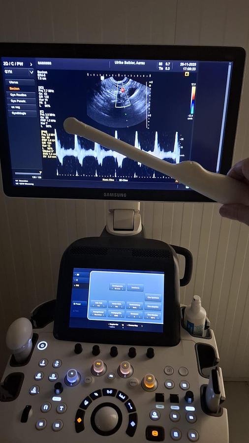 Rénové ECHOGRAPHE GYNECOLOGIQUE SAMSUNG H60