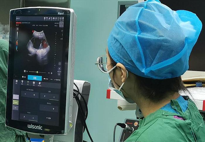 D'occasion ECHOGRAPHE WISONIC NAVI