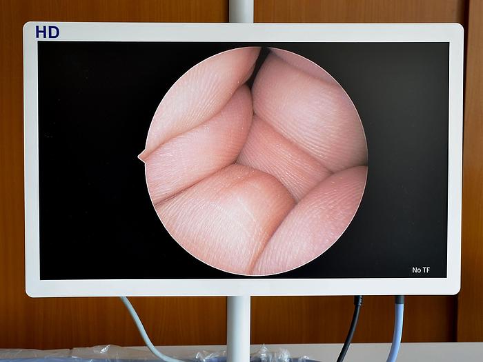 original-neuf-camera-video-endoscopique-numerique-delon.JPG