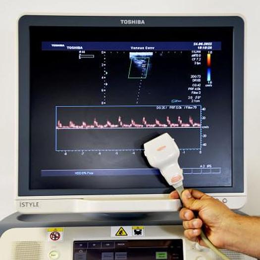 Used TOSHIBA XARIO XG SSA-680A ULTRASOUND SCANNER