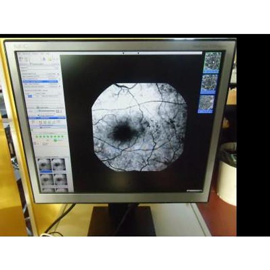 Used TOPCON TRC-50DX DIGITAL RETINAL IMAGING SYSTEM WITH PC AND RFI 3000 SOFTWARE