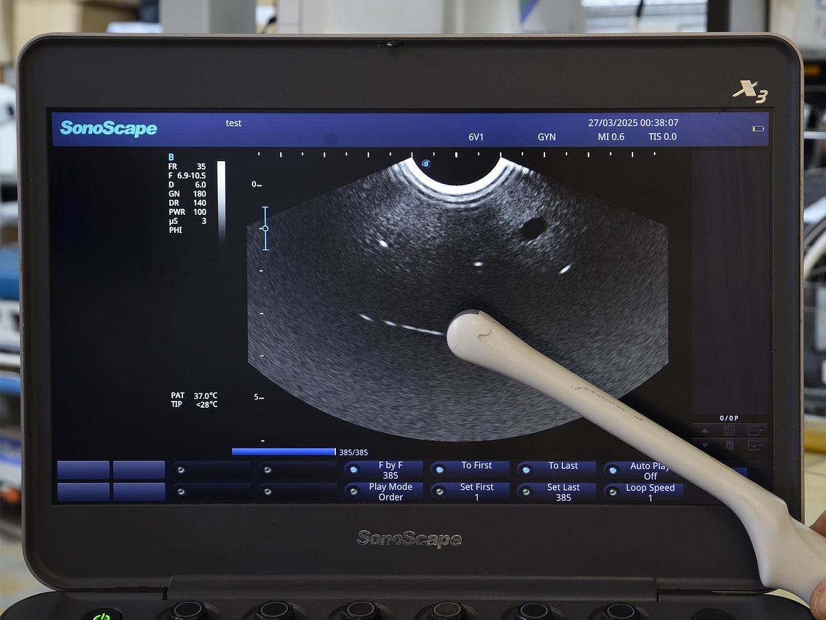 original-d-occasion-echographe-portable-sonoscape-x3-avec-2-sondes-convexe-et-endocavitaire.JPG
