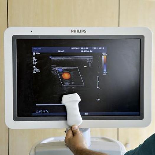 Used PHILIPS IU22 VASCULAR ULTRASOUND SCANNER