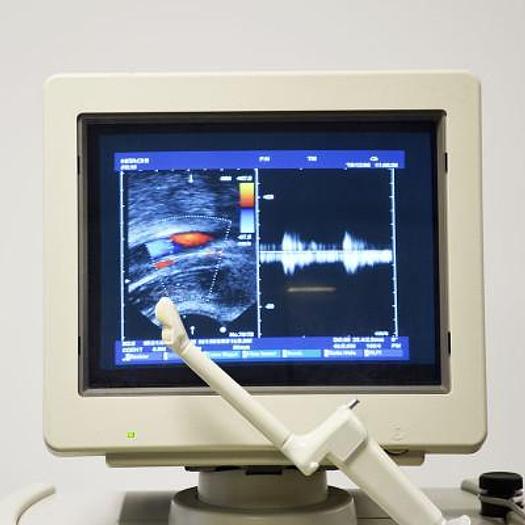 Used HITACHI EUB-5500 ULTRASOUND SCANNER