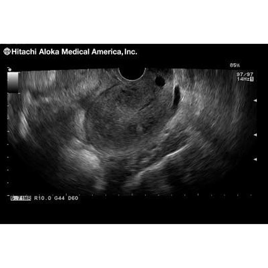 Used ALOKA/HITACHI PROSOUND 3500SX COLOR ULTRASOUND SCANNER