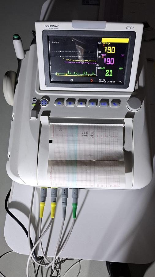 Rénové TOCOCARDIOGRAPHE CTG  PHILIPS GOLDWAY (gemellaire) FHR FETAL MONITOR TWINS