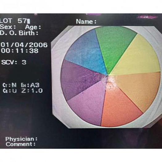 Used VIDEO COLONOSCOPE OLYMPUS CF-Q260DL