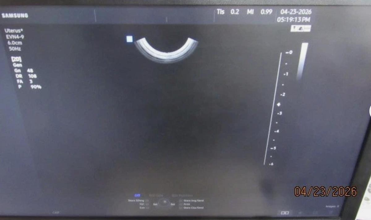 D'occasion SAMSUNG HS50 ULTRASOUND (11/2020)