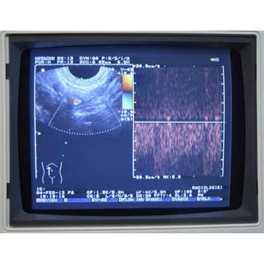 Used HITACHI EUB 525 COLOR DOPPLER ULTRASOUND SCANNER WITH 3 PROBES