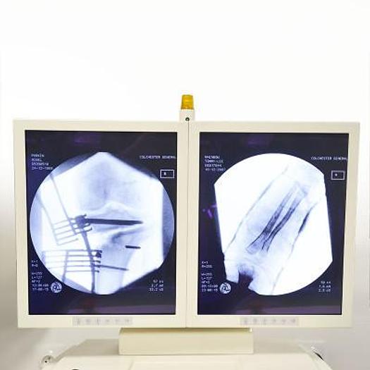 Used ZIEHM VISTA IMAGE INTENSIFIER WITH DUAL DISPLAY