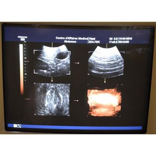 Used 3D/4D ULTRASOUND SCANNER MEDISON ACCUVIX XQ WITH VOLUME PROBE