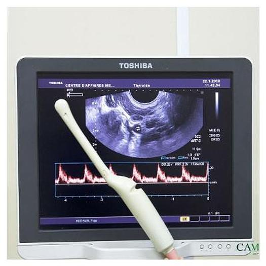 Used TOSHIBA XARIO COLOR DOPPLER ULTRASOUND SCANNER WITH 2 PROBES