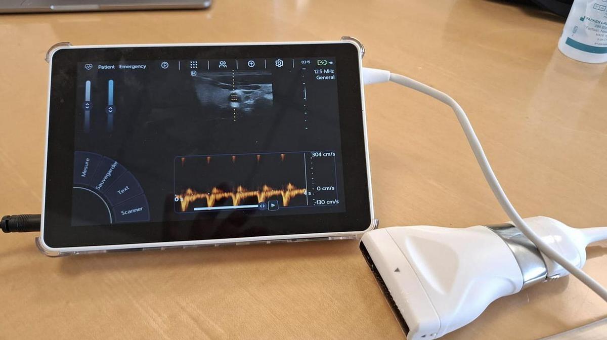 D'occasion ECHOGRAPHE SUPER PORTABLE SONOSCANNER U-LITE PRO AVEC 3 sondes interchangeables : convexe, lineaire, cardiaque