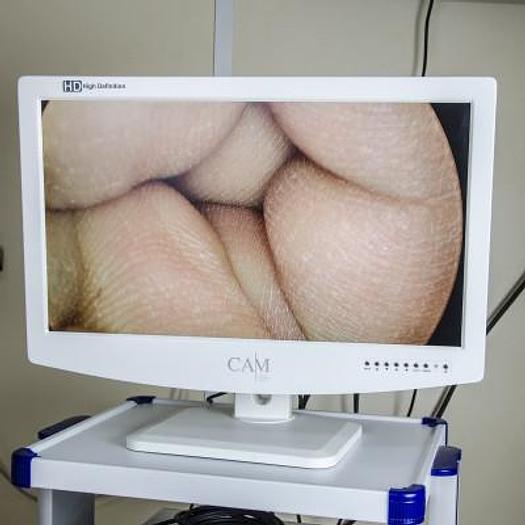 HIGH-DEFINITION ENDOSCOPY COLUMN WITH INSUFFLATOR