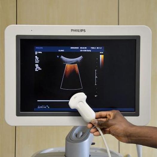 Used PHILIPS IU22 3D/4D RADIO ECHOCARDIOGRAPH + CARDIO + GYNECO