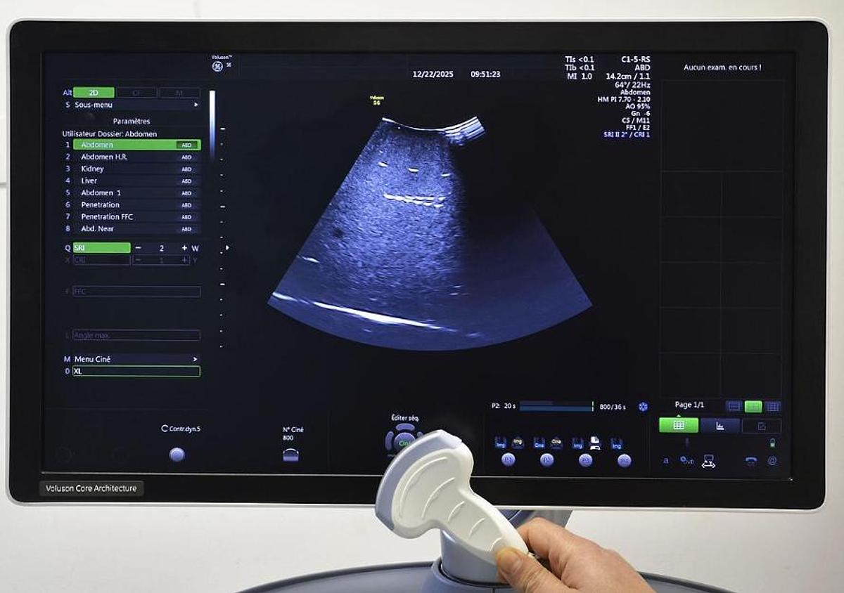 D'occasion GENEAL ELECTRIC VOLUSON S6 ULTRASOUND UNIT