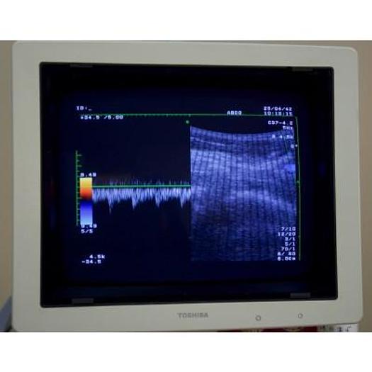 Used TOSHIBA POWERVISION COLOR DOPPLER ULTRASOUND SCANNER