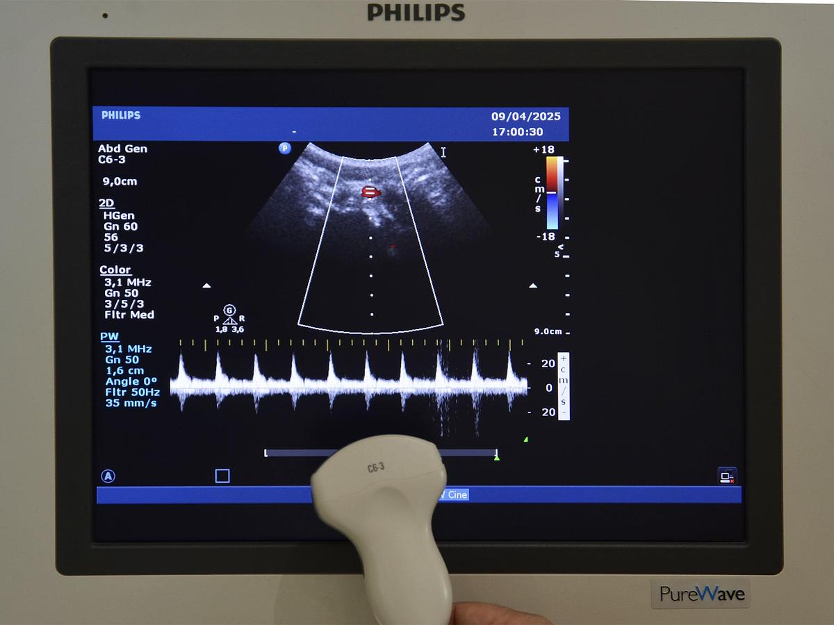 original-d-occasion-echographe-philips-hd-15-2-d-3-d-4-d-gyneco-et-radio.JPG
