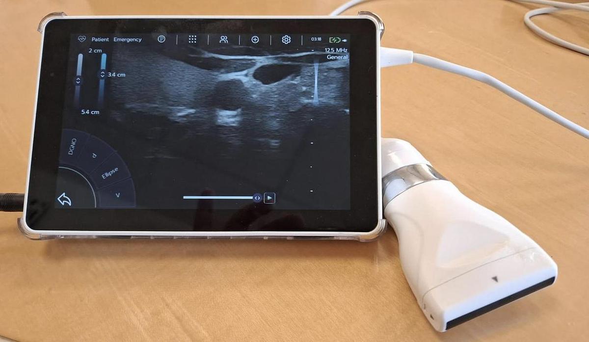 D'occasion ULTRA LITE SONOSCANNER AVEC SONDE LINEAIRE