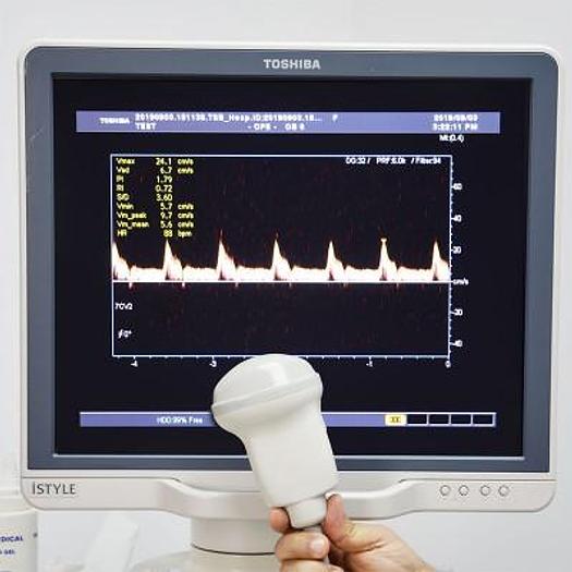 Used TOSHIBA APLIO XG ISTYLE ULTRASOUND WITH 6 PROBES INCLUDING 3D/4D AND FLAT SCREEN