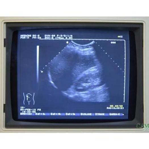 Used HITACHI EUB 525 COLOR DOPPLER ULTRASOUND WITH 2 PROBES
