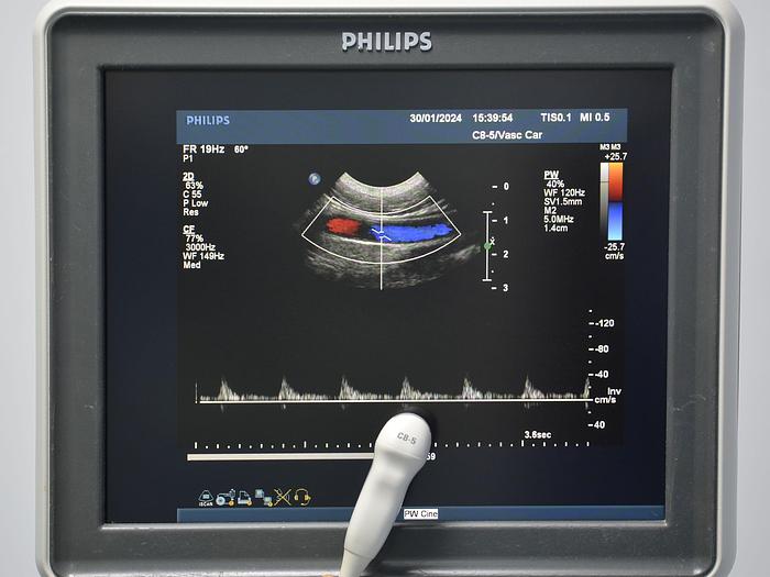 D'occasion ECHOGRAPHE PHILIPS IU22