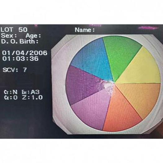 Used VIDEO GASTROSCOPE OLYMPUS GIF-H260