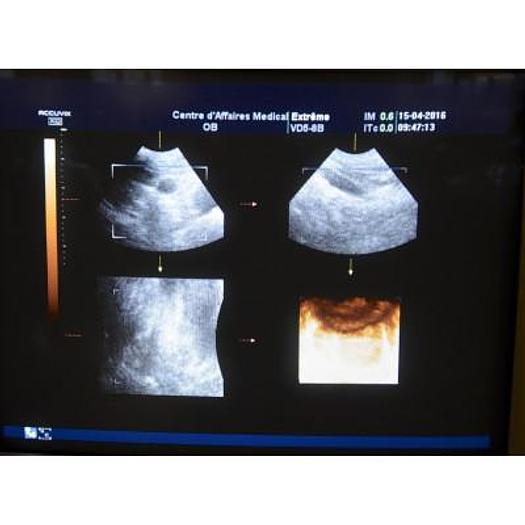 Used ACCUVIX XQ 3D/4D ULTRASOUND SCANNER WITH 4 PROBES