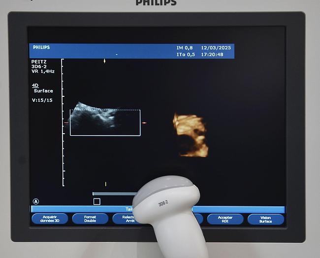 original-d-occasion-echographe-philips-hd-11-xe.JPG