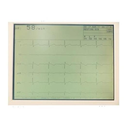 Used E.C.G SCHILLER AT-5 6 TRACKS WITH INTERPRETATION SOFTWARE