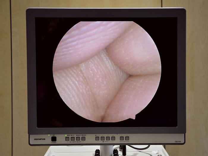 Used OLYMPUS CABINET COLUMN FOR EUROLOGY-GYNECO-ORL