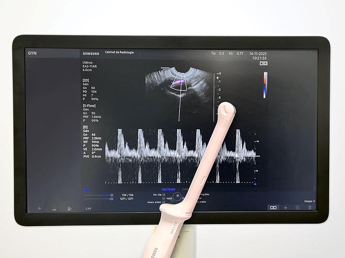 Used SAMSUNG HS 50 ULTRASOUND SCANNER