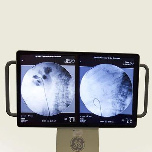 Used BRILLIANCE AMPLIFIER (04/2018) GENERAL ELECTRIC FLUOROSTAR for general and vascular applications