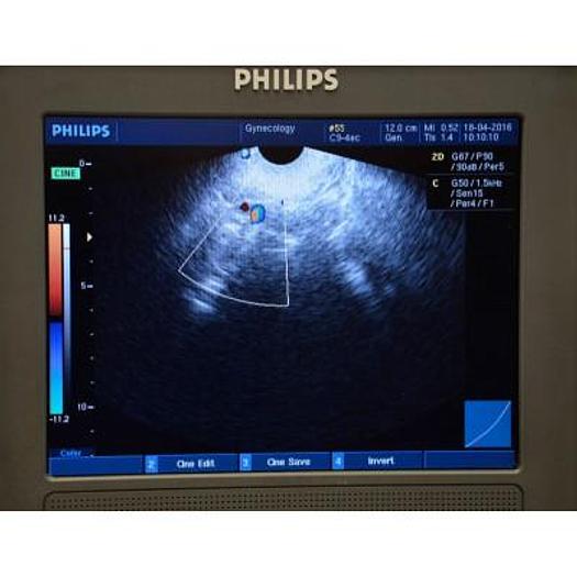 Used PHILIPS HD3 COLOR DOPPLER ULTRASOUND WITH ABDOMINAL PROBE AND ENDOVAGINAL PROBE