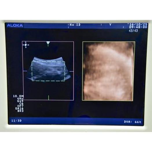 Used ALOKA/HITACHI PROSOUND 3500SX COLOR 3D/4D DOPPLER ULTRASOUND SCANNER