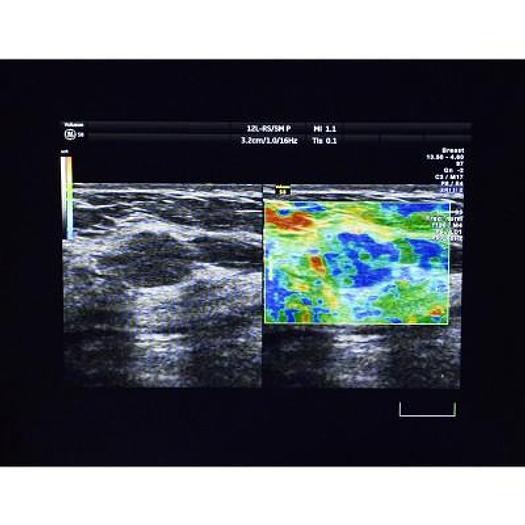 Used VOLUSON S8 HEALTHCARE 3D/4D GE ULTRASOUND SCANNER